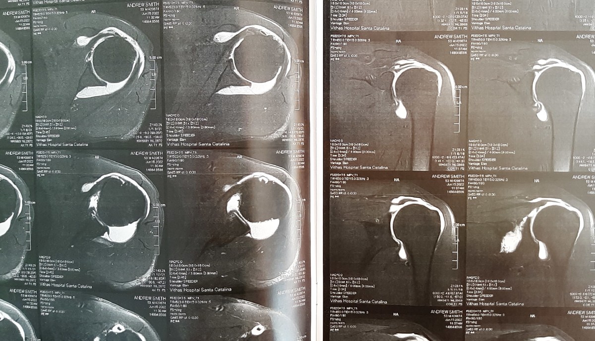 The Long Road to…&nbsp;Surgery